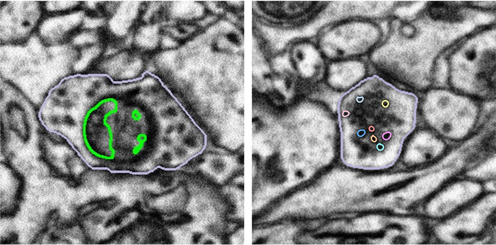 Two black and white electron microscopy images, The left one is a dark circle with a few large circles marked in green. The right image has a large grey circle with lots of smaller colourful circles highlighted.