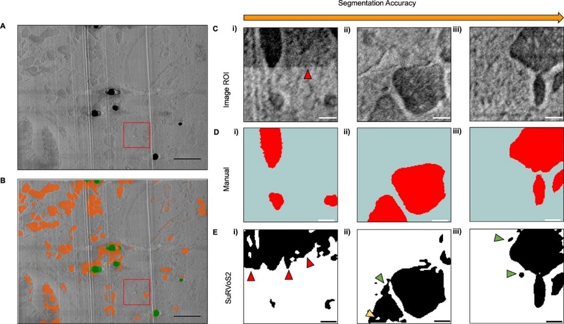 Tools for Efficient Annotation of Complex Bioimage Data - Rosalind ...